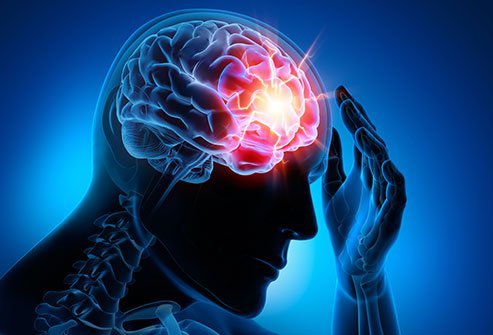 Traumatic Brain Injury 