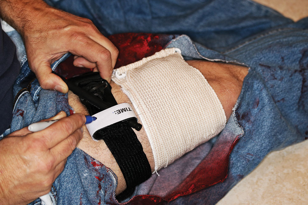 Controlling an Uncontrolled External Hemorrhage